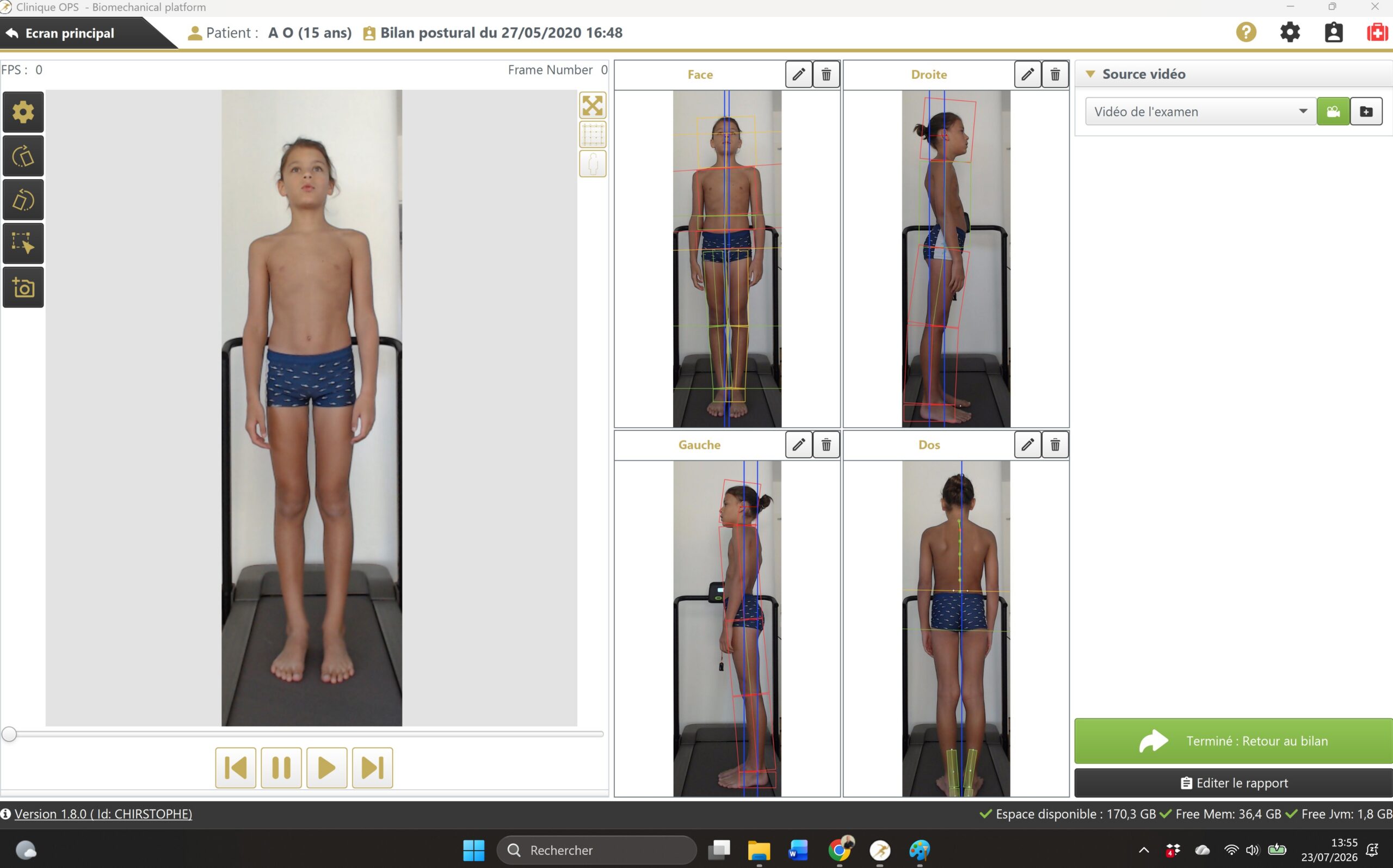 Analyse de la posture enfant - logiciel OPS