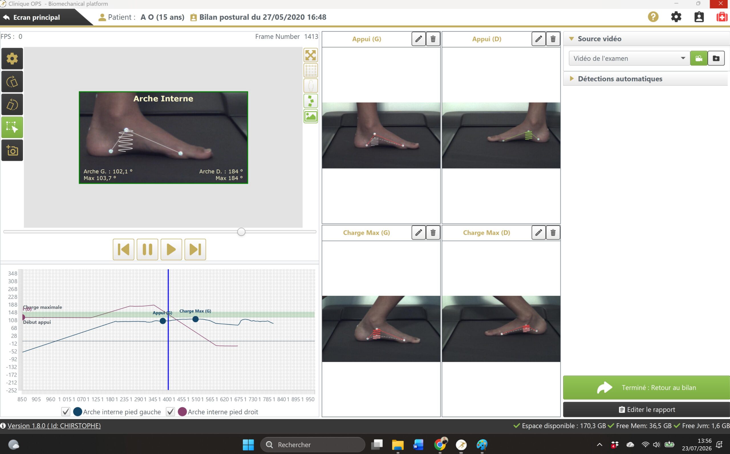 Analyse pied enfant - logiciel OPS